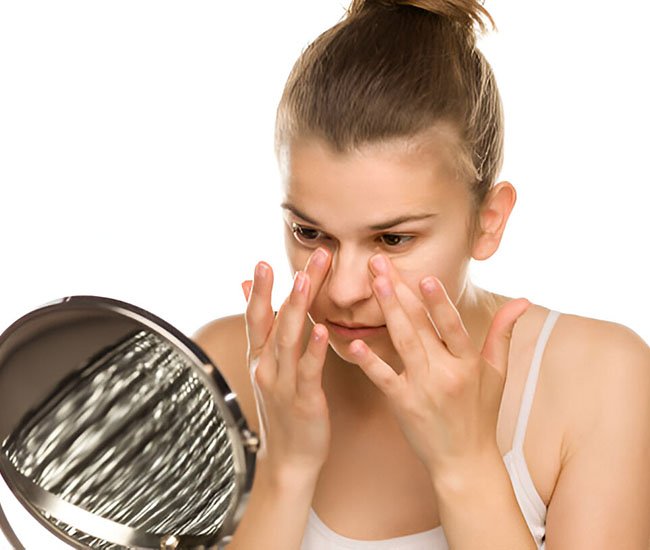 How I Improved My Chronic Dark Circles With Skincare and Lifestyle Changes How I Improved My Chronic Dark Circles With Skincare and Lifestyle Changes